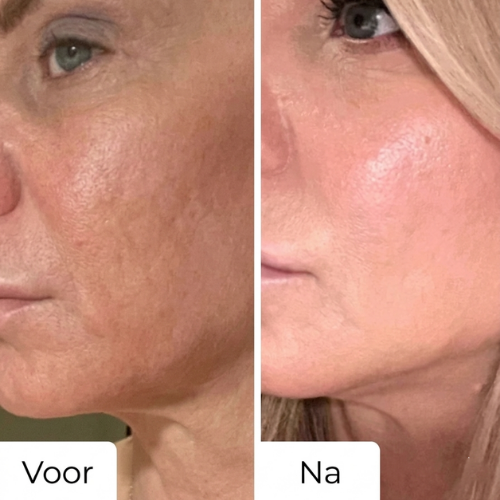 Lumina - 7-in-1 LED Lichttherapie Gezichtsmasker